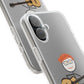 Flexi Case – Ed Sheeran guitar edition (iPhone X–16 Pro Max)
